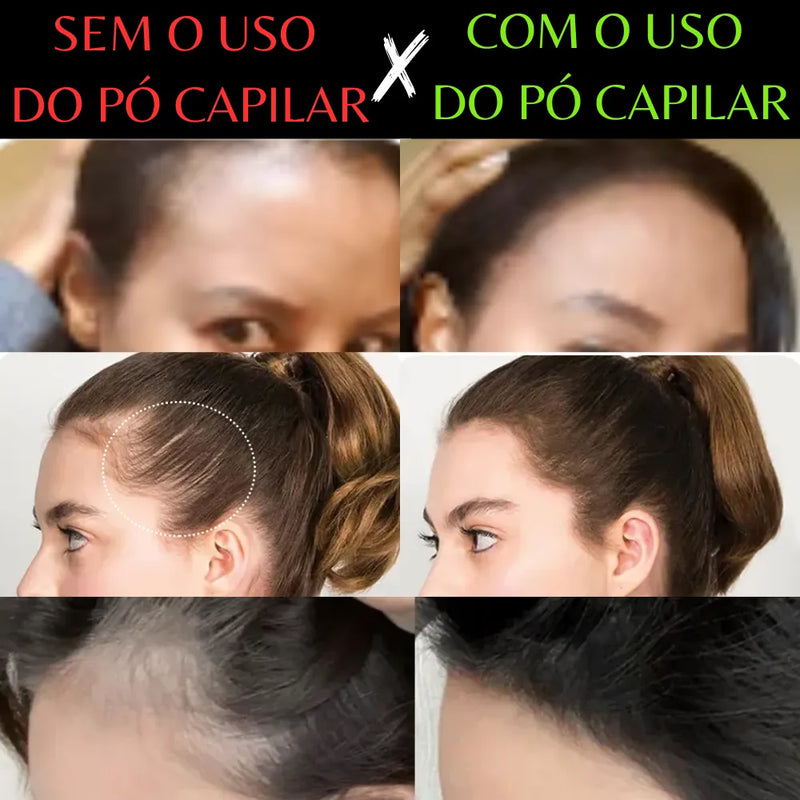 Pó Capilar - preenchimento e correção de falhas, alopécia, calvície, cabelos brancos e realce de beleza - 🔥COMPRE 1, LEVE 3🔥